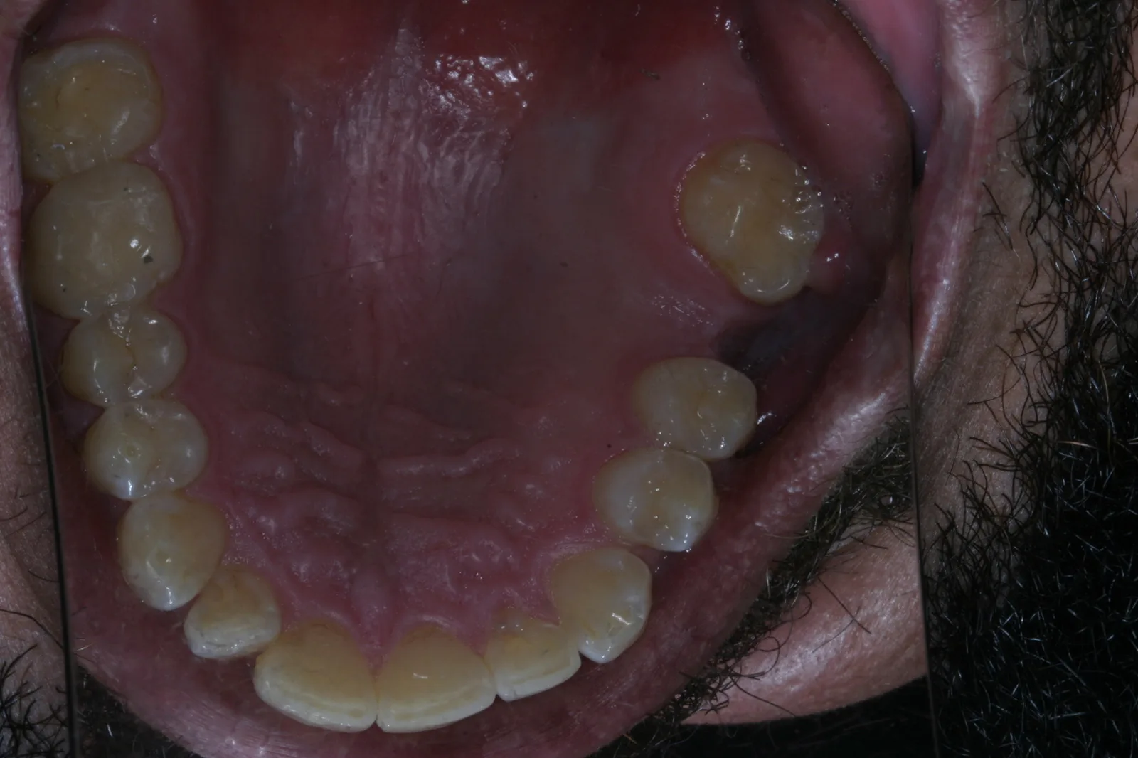 Smile gallery case 10 — before treatment
